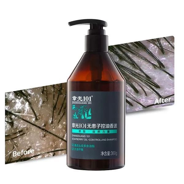 Шампунь для жирного волосся Фабао проти випадіння Zhangguang 101 Best Oil Control Shampoo 360 мл 0272 фото